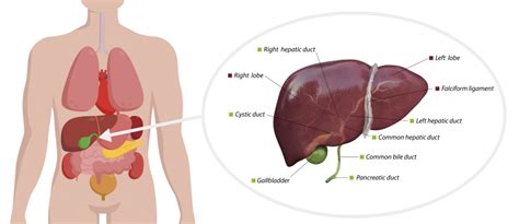 Gallbladder Polyps - Harbour Surgery Centre