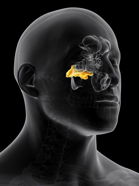 Sphenoid sinus location | Sinus disease, Sinus infection, Sinusitis