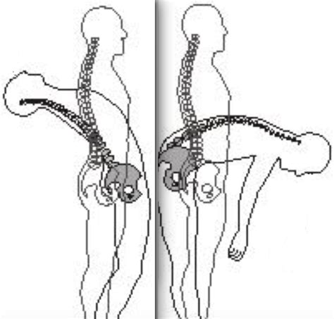 spine-flexion-extension-2 | b-reddy.org