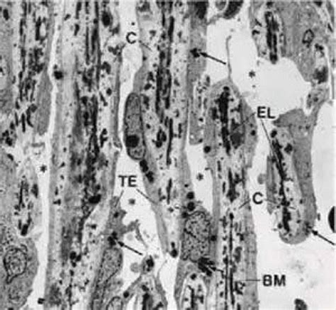 Functional Morphology of the Trabecular Meshwork | Ento Key