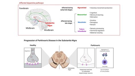 Parkinson's Disease Program - Neural Stem Cell Institute, Rensselaer NY