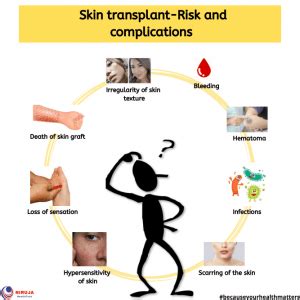 Skin transplant: Risk and Complications