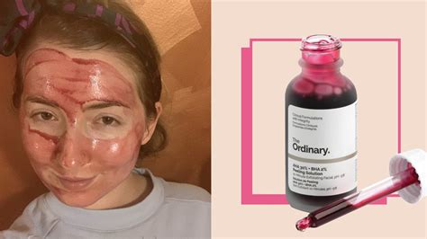 The Ordinary Peeling Solution Review: Why It’s Worth It | Glamour