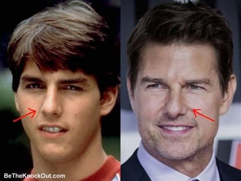 Total 93+ imagen tom cruise before and after plastic surgery - fr.thptnganamst.edu.vn