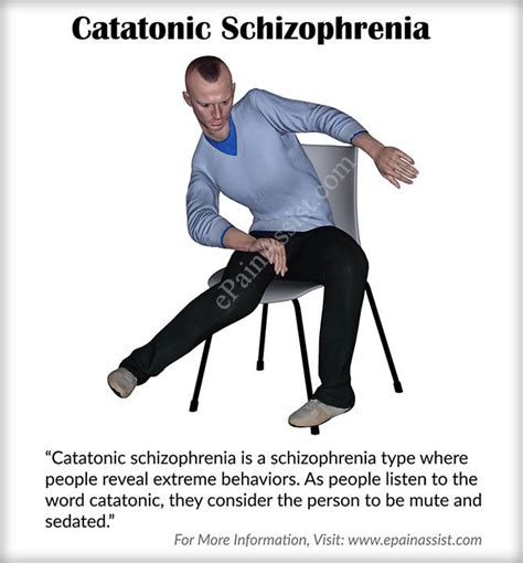 Catatonic Schizophrenia | Catatonic schizophrenia, Schizophrenia, Schizophrenia treatment