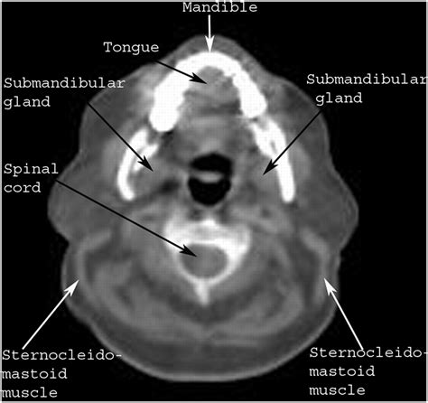 ct neck anatomy