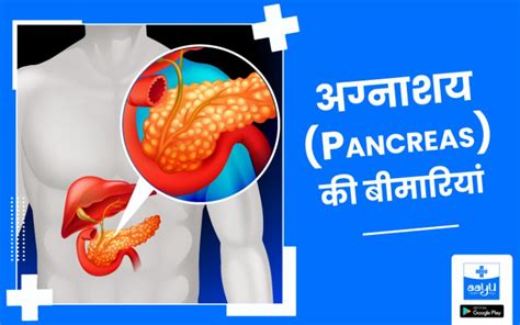 अग्नाशय क्या है -Pancreas In Hindi