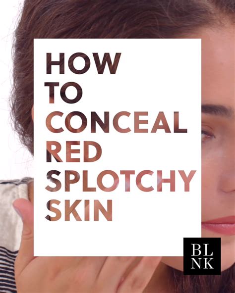 How to Conceal Red Splotchy Skin. #blinkbeauty #makeup #tutorial ...