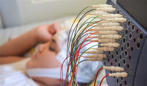 The Evolving Art of Epilepsy Surgery - Vanderbilt Discover