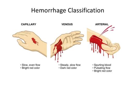 Hemorrhage