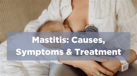 Treatment for Mastitis in NYC — FemFirstHealth