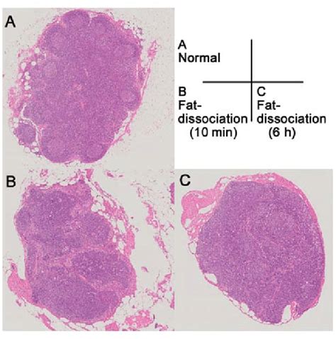 Pathological examination of lymph nodes by the conventional or the new... | Download Scientific ...