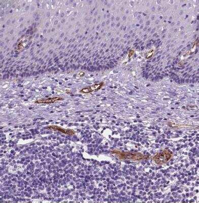 Von Willebrand Factor Antibody (NBP1-84762): Novus Biologicals