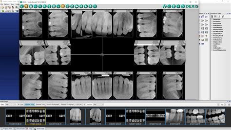 DEXIS Smart Image | Dentrix