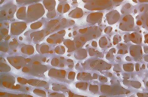 Close-up of normal human spongy bone - Stock Image - P105/0067 ...