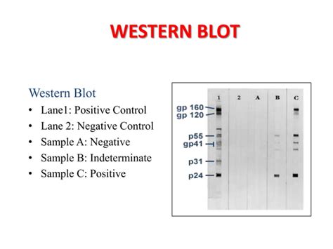 immunoblotting techniques