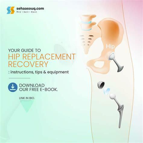 Tips To Get Total Hip Replacement Recovery | by Sehaasouq | Medium