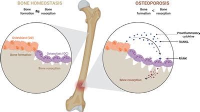 Frontiers | Immunoporosis: Role of Innate Immune Cells in Osteoporosis