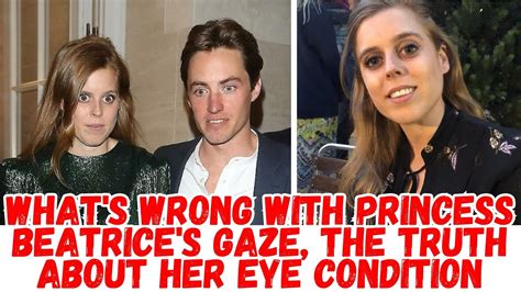 What's Wrong with Princess Beatrice's Gaze, the Truth About Her Eye ...