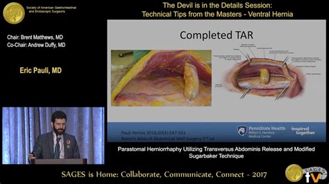 Parastomal herniorrhaphy utilizing transversus abdominis release & modified Sugarbaker technique ...