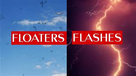 FLOATERS & FLASHES in EYE (photopsias) - YouTube