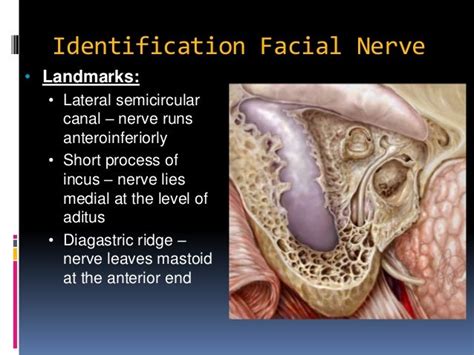 Cortical mastoidectomy