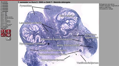 HISTOLOGI (CNS): MEDULLA OBLONGATA - YouTube