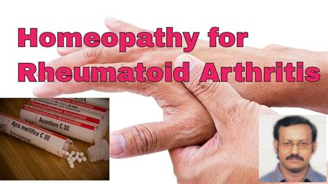 Rheumatoid arthritis homeopathic treatment/Rheumatoid arthritis homeopathy - YouTube