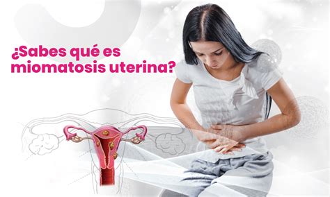 Operacion De Fibromas Uterinos - garbstory