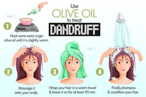 Home Remedies for Dandruff | Top 10 Home Remedies