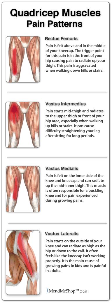 Quadriceps Muscle Strain