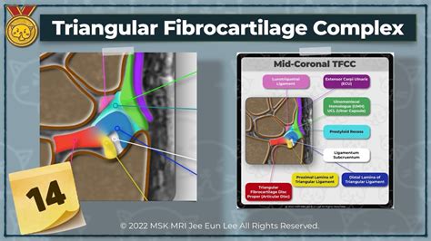 [Anatomy_14] Triangular fibrocartilage complex (TFCC), wrist MRI - YouTube