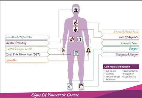 Are there any early warning signs of pancreatic cancer? – ouestny.com