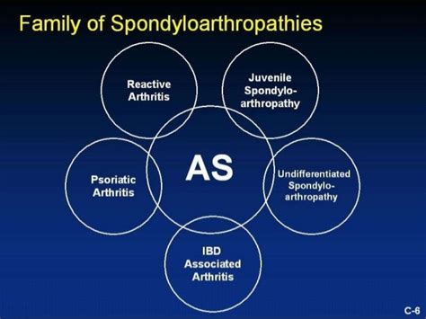 Seronegative Spondyloarthropathies