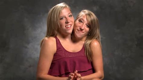 Conjoined Twin Sisters Abby and Brittany Hensel: Where are they Now ...