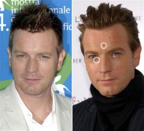 Ewan McGregor reveals he had a cancerous mole removed from his face ...