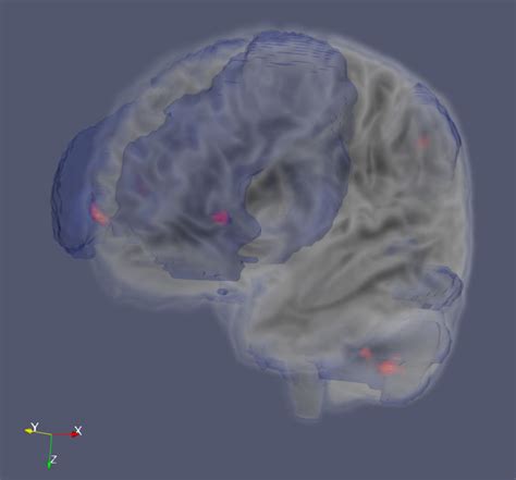 Brain Activation Visualization · Advanced Visualization Lab