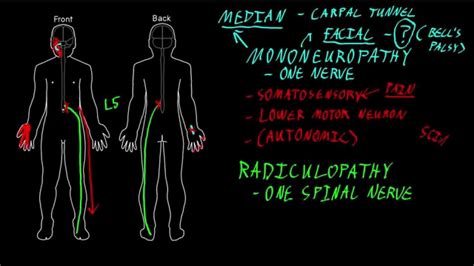 Mononeuropathy and radiculopathy - YouTube