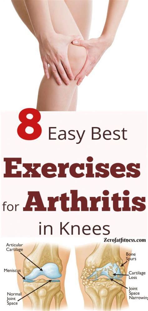 Pin auf Arthritis Joint Care