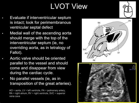 Fetal Cardiac Screening Sonography – Radiology.World