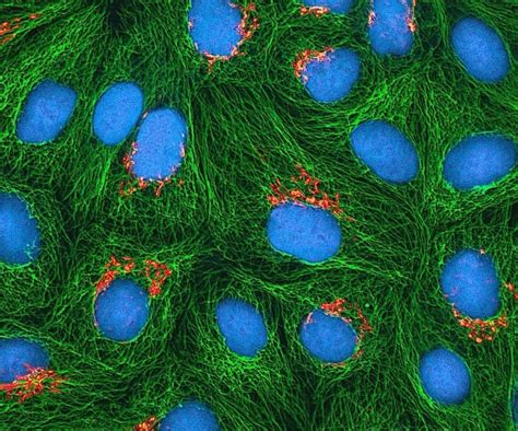 Antibody production: hybridoma technology as the preferred method for therapeutic applications?