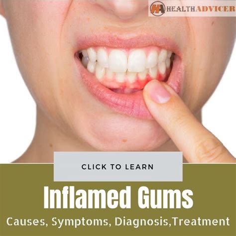 Inflamed Gums: Causes, Symptoms, Diagnosis And Treatment