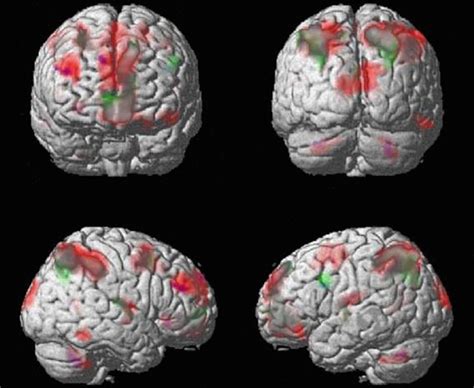 Brain on drugs scans - Business Insider