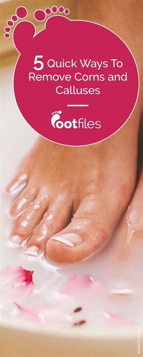 Treat corns and calluses too tough for foot cream with these podiatrist approved | Foot cream ...