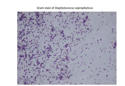 Solved Activity 2: Review the Gram stain images of the | Chegg.com