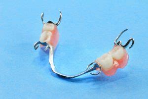 Getting Dentures: What Are The Common Partial Denture Problems?