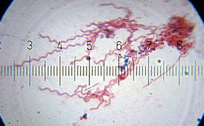 Spirochaeta - microbewiki