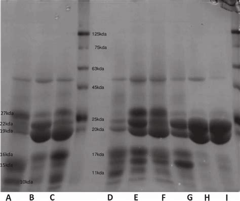 SDS-PAGE analysis of zein protein from normal (lane E to I), opaque-2 ...