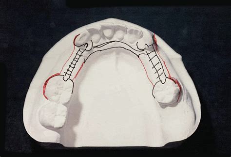 Understanding Design 3 - TCS Dental Inc