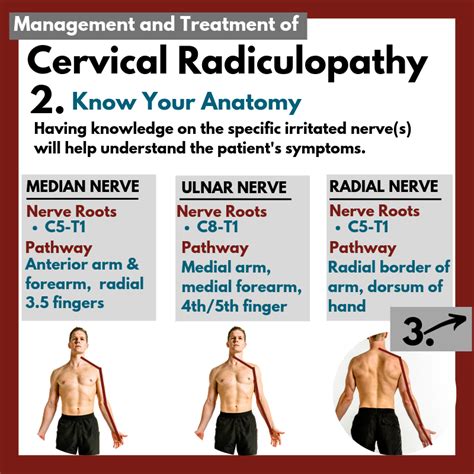 cervical radiculopathy home exercises pdf - Mora Hare